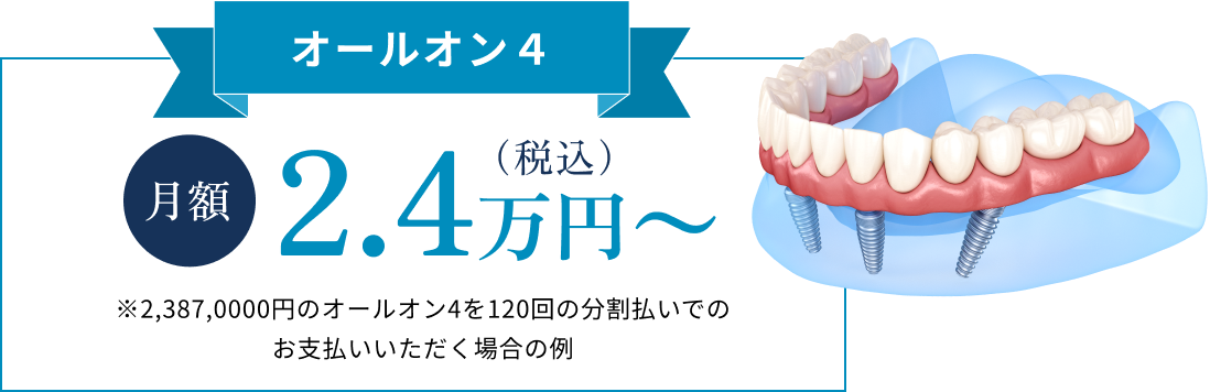 オールオン4　月額2.5万円～（税込）　※000円のオールオン4を00回の分割払いでのお支払いいただく場合の例